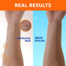 Zevo On-Body Aerosol Spray Insect Repellent Liquid For Mosquitoes/Ticks 6 oz